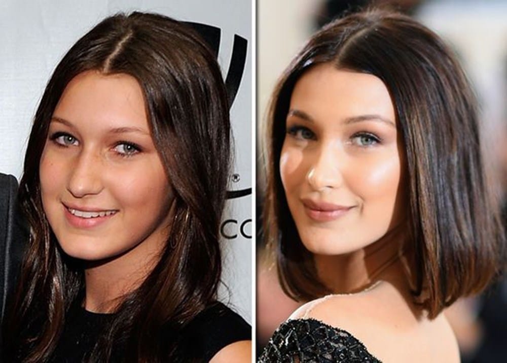 bella hadid estetiksiz hali