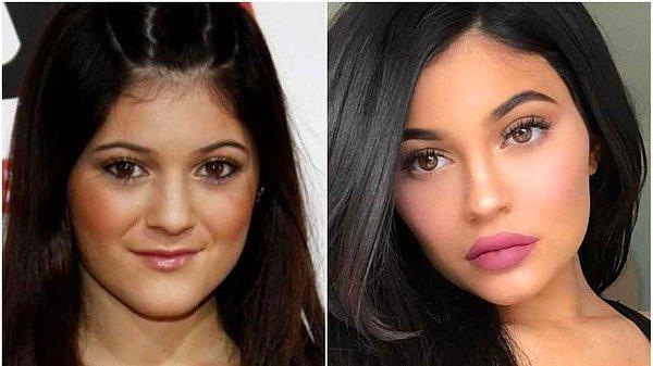 kylie jenner estetiksiz